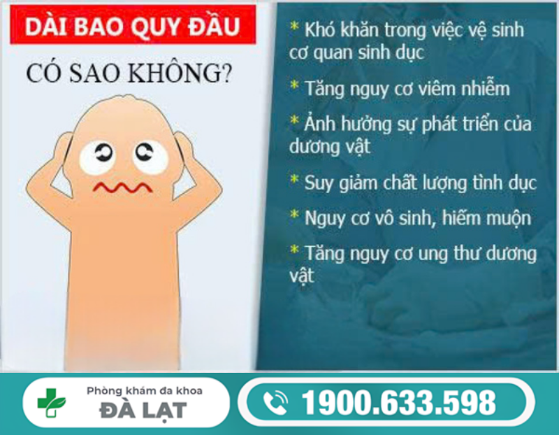 Hình ảnh minh họa